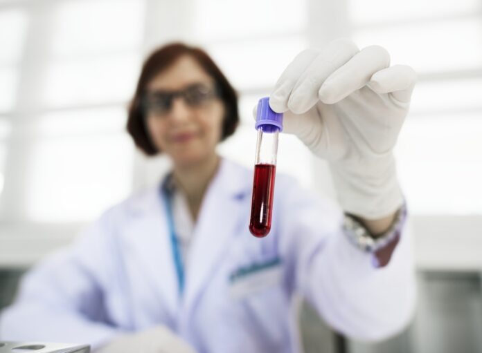 Imagem de médica segurando tubo de sangue para análise, presente no texto do blog da Sami que trata sobre a relação dos laboratórios de análises clínicas com os planos de saúde